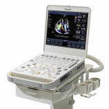 New Philips CX50 Ultrasound Portable System - For Sale