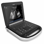 New Portable SonoSite Edge Ultrasound System 1 Probe - For Sale
