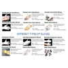 Surgical Gloves & Protective Gloves