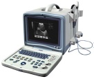 Full Digital Portable Ultrasound Scanner - AJ-6116 