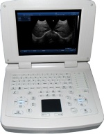 ATNL200 Full Digital notebook Ultrasound Scanner