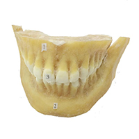 Human permanent teeth in situ plastinated specimens