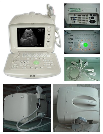 Portable Ultrasound Scanner XK21355