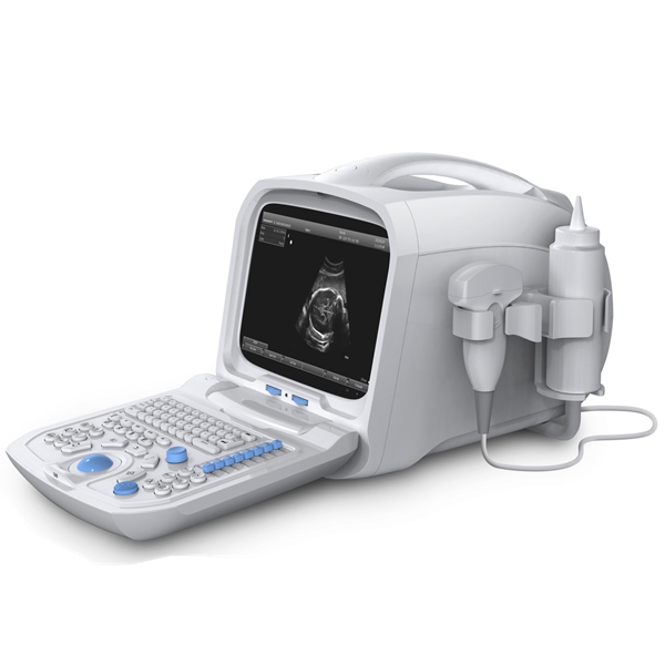 U660 ultrasound device