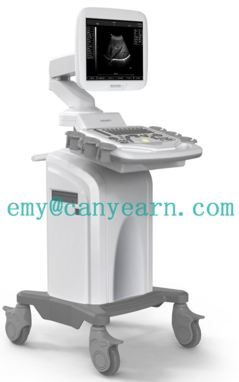 U680 Trolly ultrasound scanner