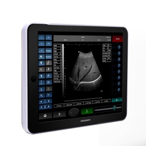 Ipad touch screen full digital ultrasound scanner