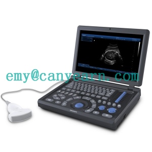 U610 full digital notebook ultrasound scanner
