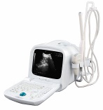 Portable Digital Ultrasound Scanner - S990