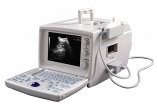 B mode Digital Ultrasound Scanner