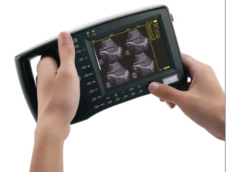 Palmtop Ultrasound Scanner for human - S550