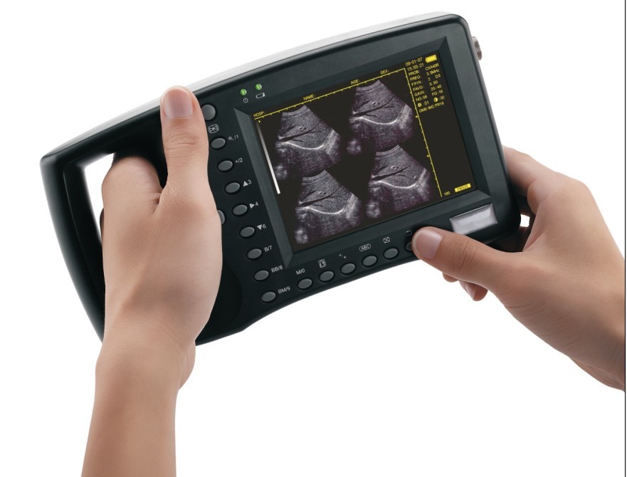 palmtop ultrasound scanner