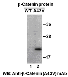 Western blot analysis of recombinant β-catenin (A43V) and wildtype proteins. Purified His-tagged β-catenin (A43V) protein (amino acids 1-76, lane 2) and corresponding wild type protein (lane 1) were blotted with anti- β-catenin (A43V) mouse monoclonal antibody (Cat. #26170).