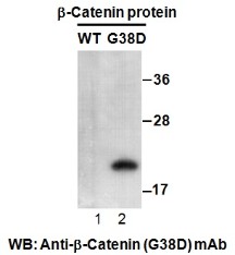 Western blot analysis of recombinant β-catenin (G38D) and wildtype proteins. Purified His-tagged β-catenin (G38D) protein (amino acids 1-76, lane 2) and corresponding wild type protein (lane 1) were blotted with anti-β-catenin (G38D) mouse monoclonal antibody (Cat. #26169).