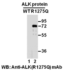 Western blot analysis of recombinant ALK (R1275Q) and wildtype proteins. Purified His-tagged ALK (R1275Q) protein (amino acids 1060-1620, lane 2) and corresponding wild type protein (lane 1) were blotted with anti-ALK (R1275Q) mouse monoclonal antibody (Cat. #26151).