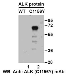 Western blot analysis of recombinant ALK (C1156Y) and wildtype proteins. Purified His-tagged ALK (C1156Y) protein (lane 2) and corresponding wildtype protein (lane 1) were blotted with anti-ALK (C1156Y) monoclonal antibody (Cat. #26226).